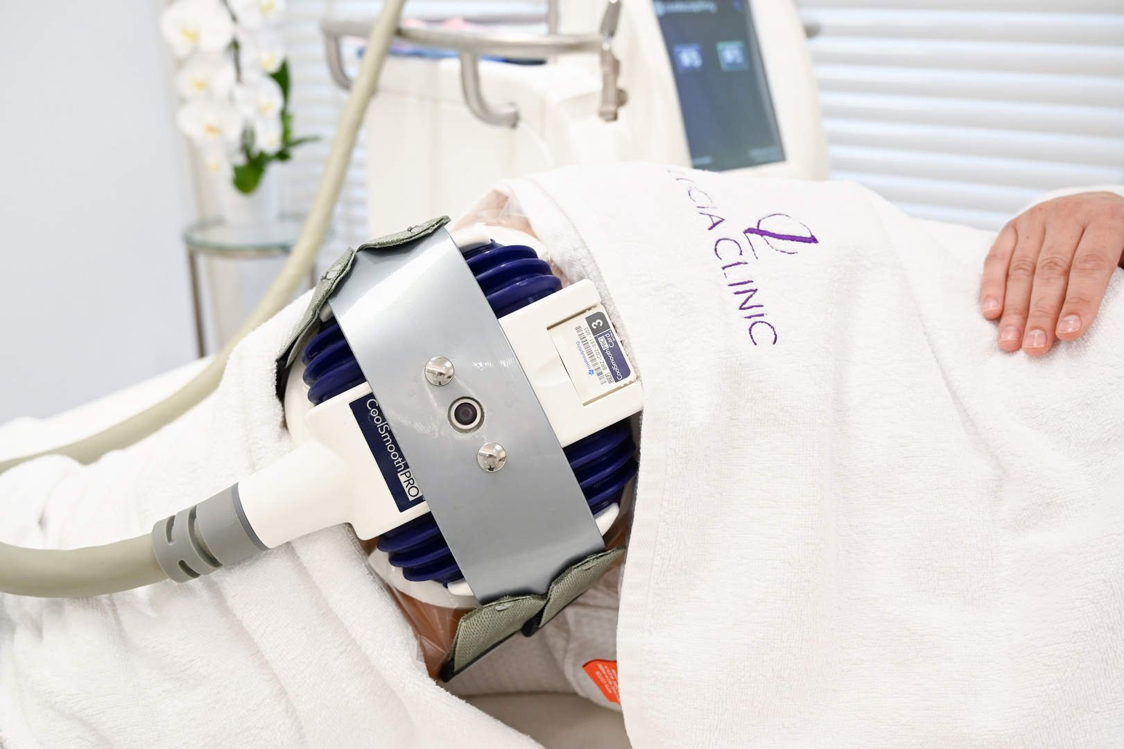 COOLSCULPTING TREATMENT FOR THIGHS