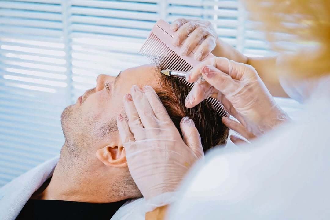 Men's Hair Loss Treatment