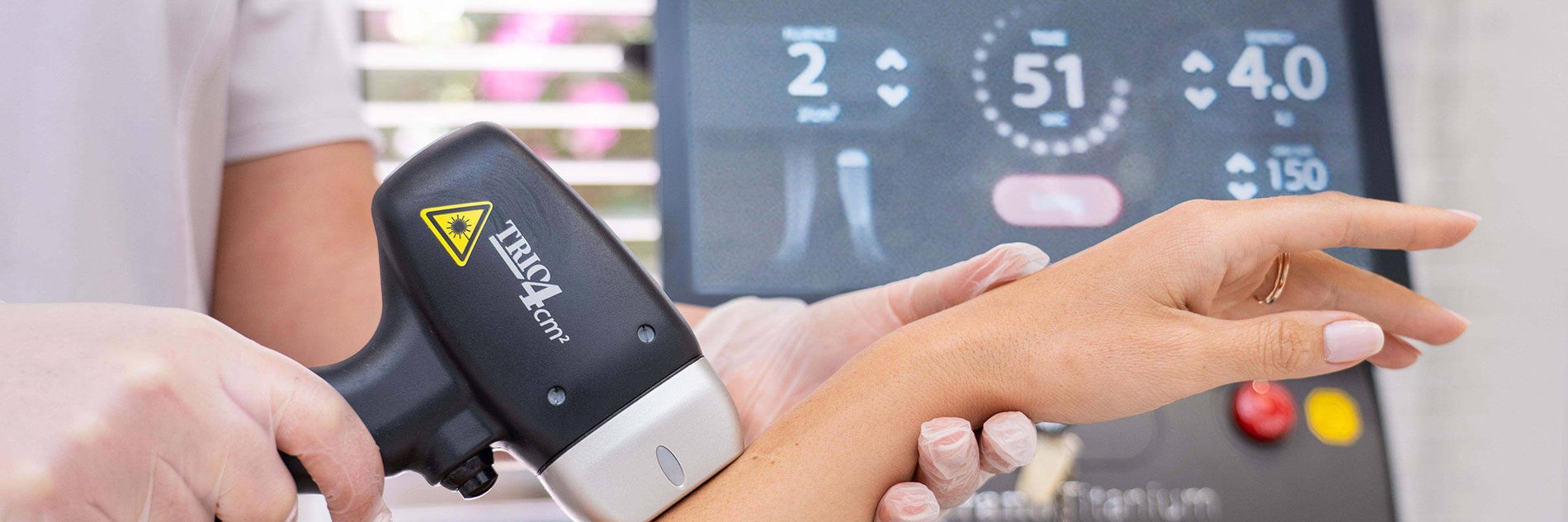 Soprano Titanium the latest laser hair removal treatment