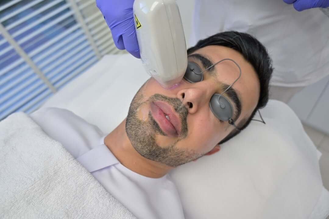 Men's Hair Reduction by Laser