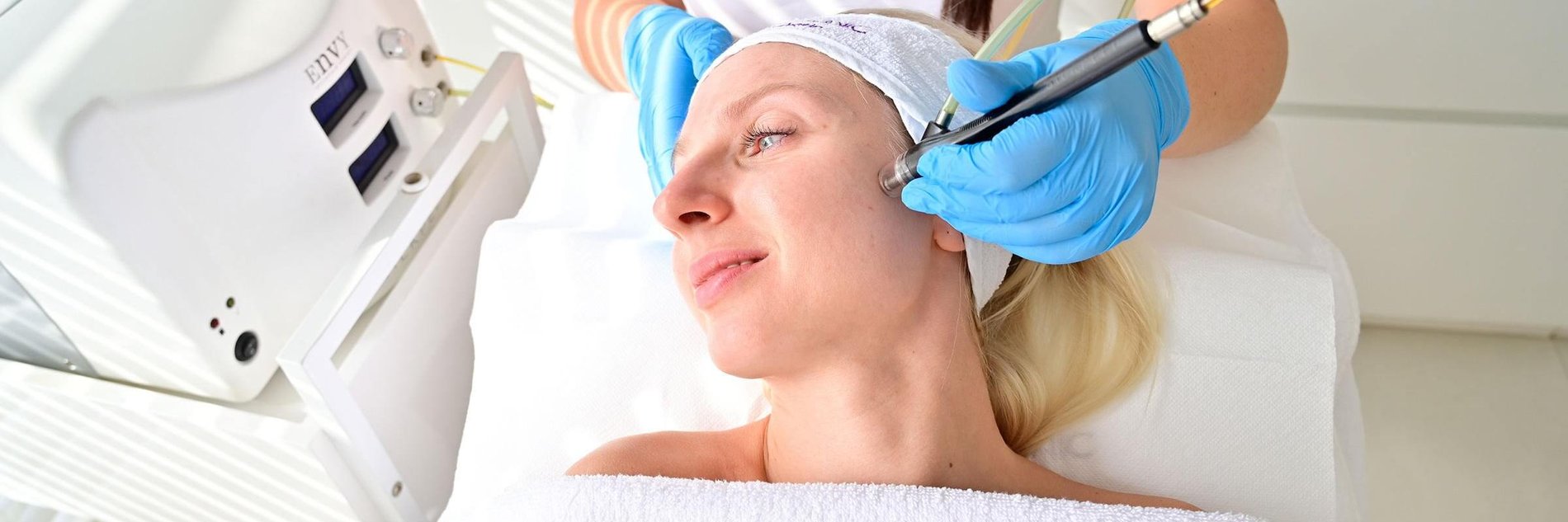 Microdermabrasion Treatment