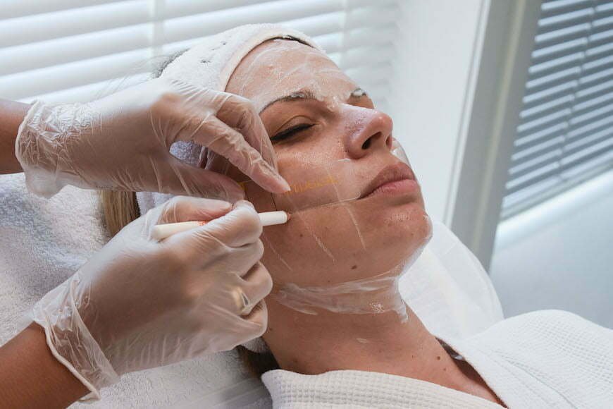 The key to Ultherapy is the careful marking of the area - preparations for the treatment ends with a precise marking of your facial area that will be addressed.