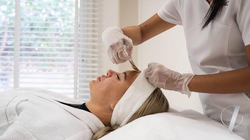 Chemical peels for flawless facial skin of future brides