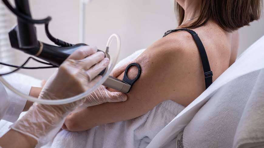 A comprehensive guide about scars and their management